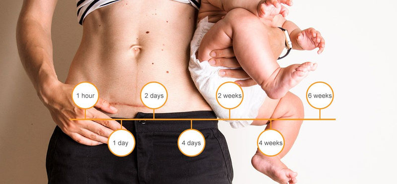C-Section Recovery