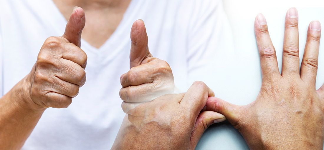 Thumb Arthritis