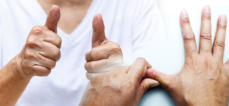 Thumb Arthritis
