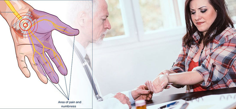 Carpal Tunnel Syndrome