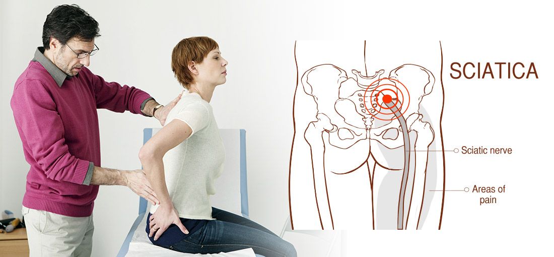 Sciatica Pain
