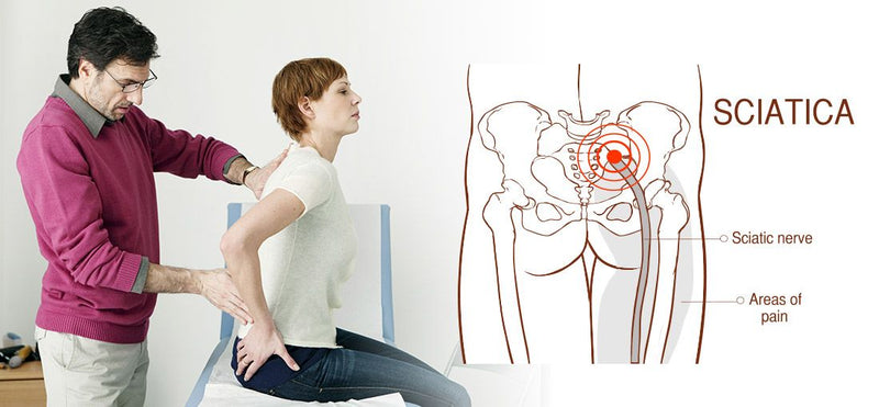 Sciatica Pain