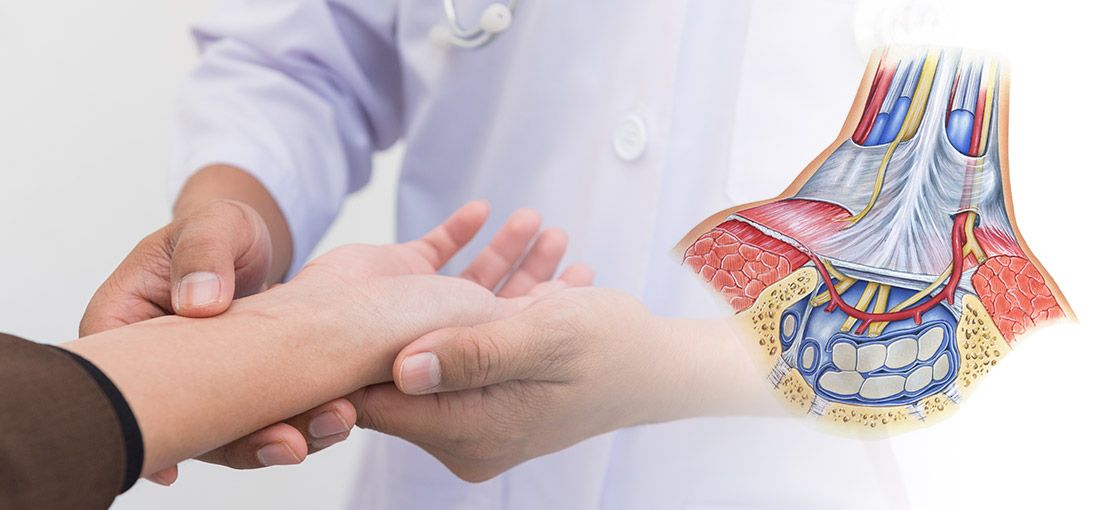 Carpal Tunnel Syndrome