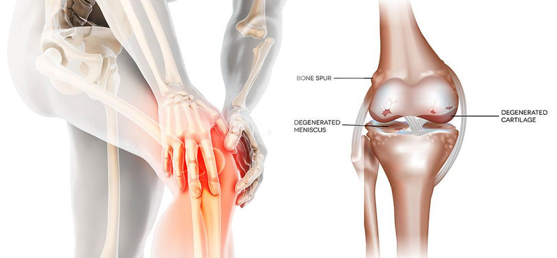Knee Pain