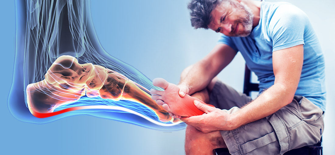 Plantar Fasciitis