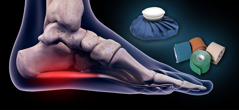 plantar fasciitis management