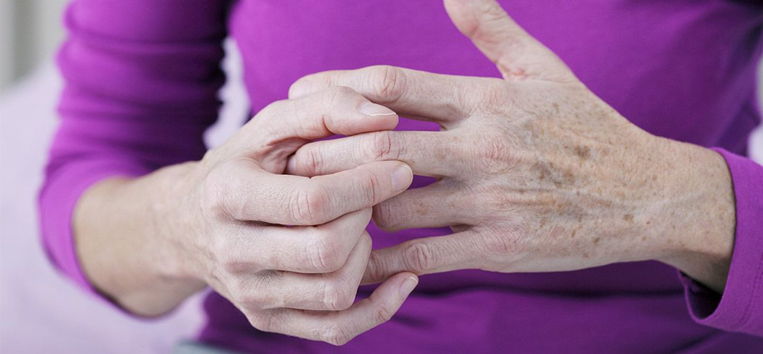 Hand Arthritis