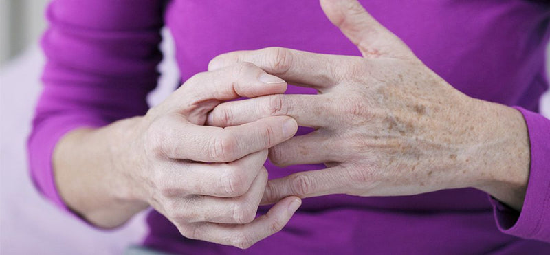 Hand Arthritis