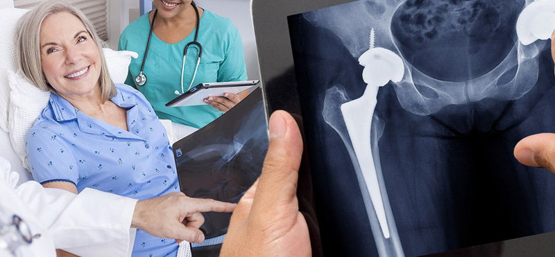 Hip Replacement: Do You Need Hip Surgery?