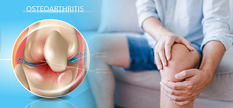 Knee Osteoarthritis
